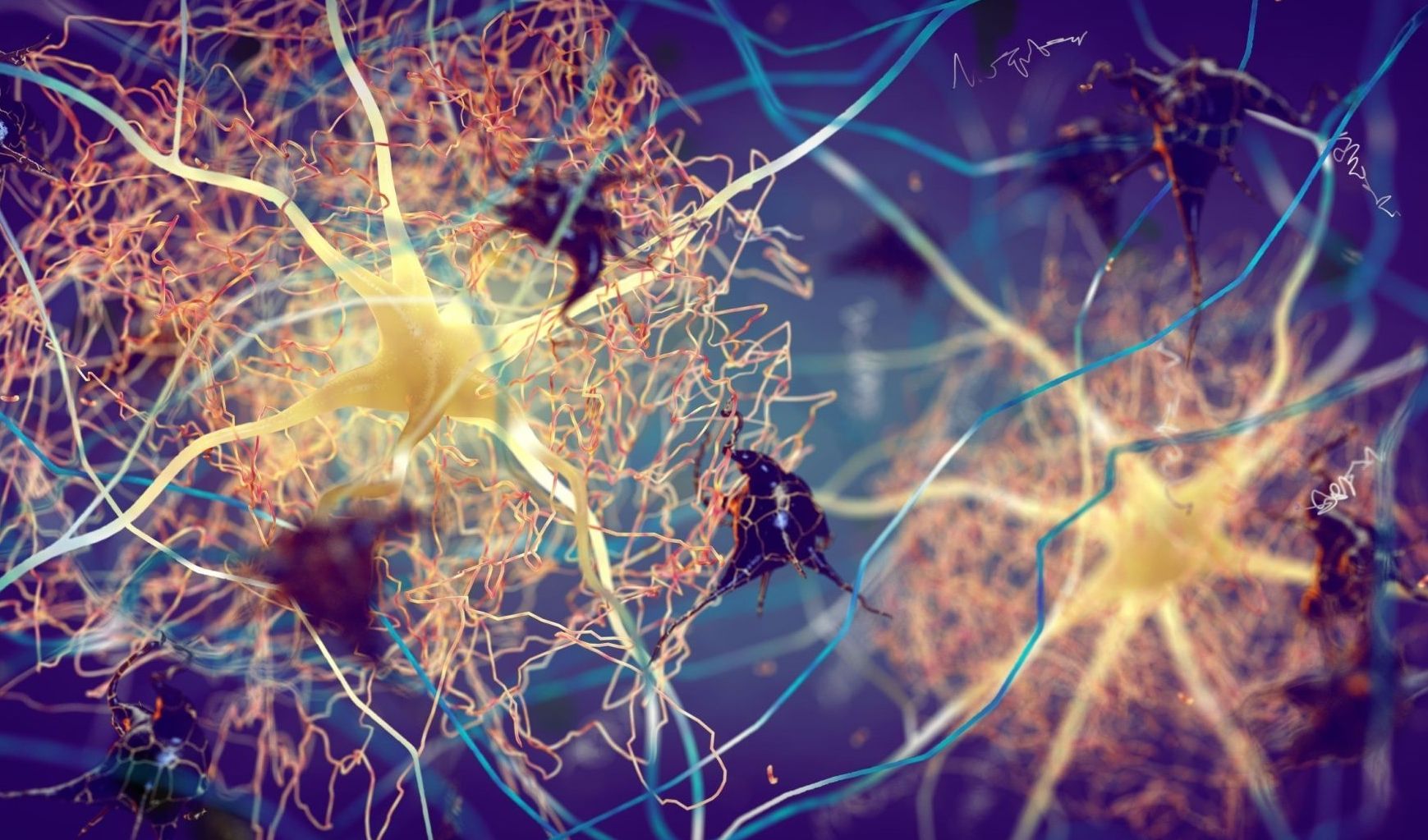 Alzheimer, Brescia in studio internazionale che innova diagnosi precoce