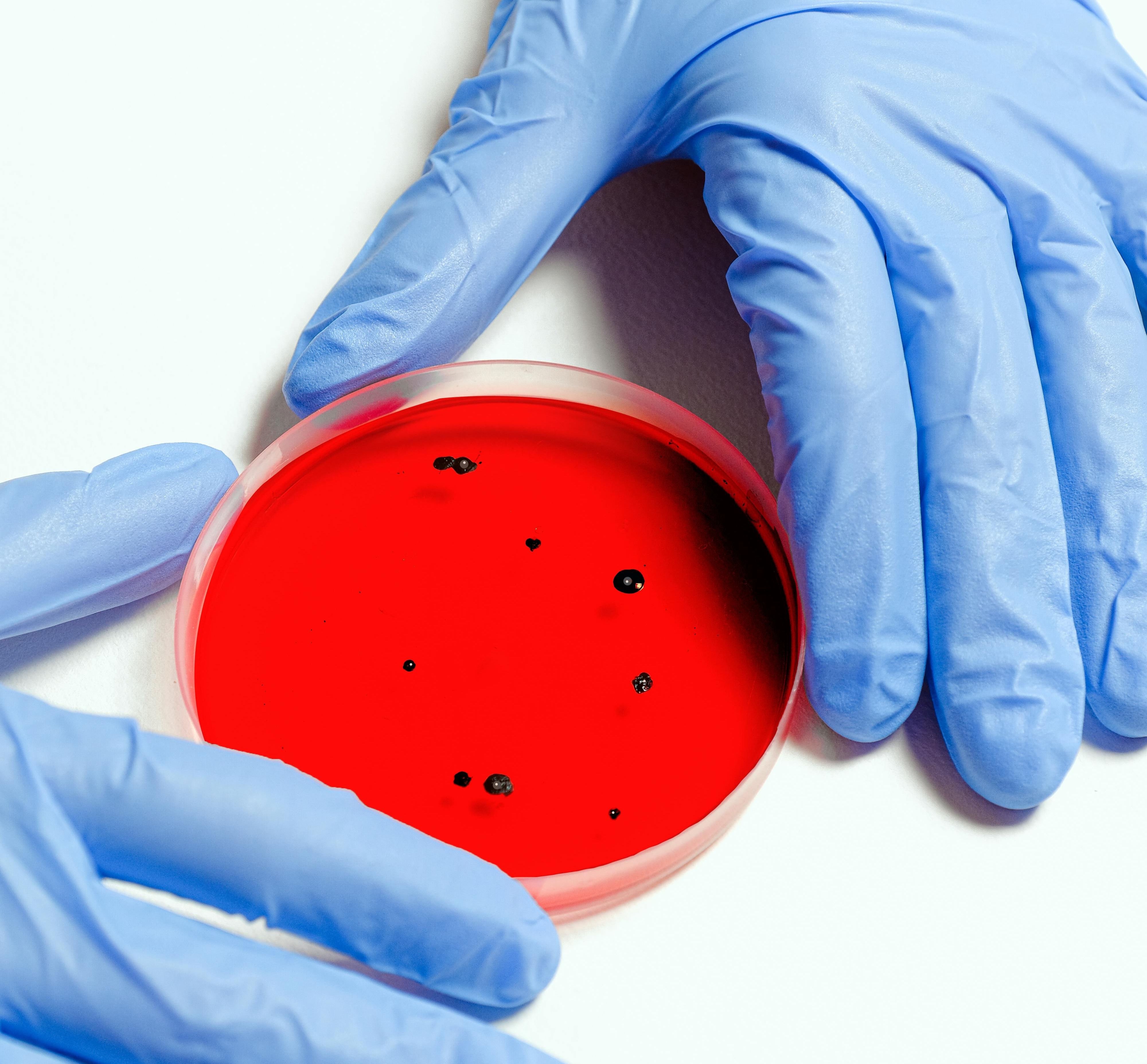 Startup tedesca cerca spazio di laboratorio per espandere la loro ricerca sugli antibiotici a base di batteriofagi