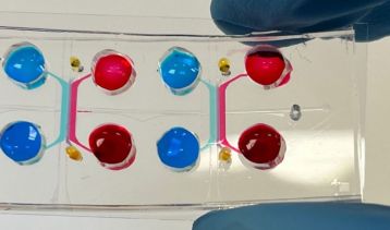 Vai alla notizia Immunoterapia e melanoma: l’efficacia si prevede con un chip del PoliMI